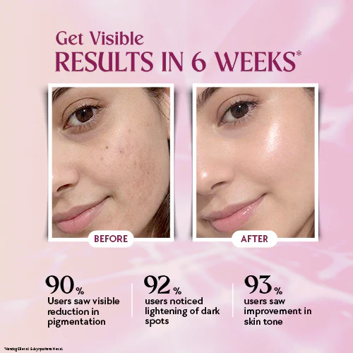 Chicnutrix Glow Advanced – Liposomal Glutathione, Ergothioneine & Strong Antioxidant Formula for Uneven Skin Tone - Image 4